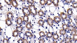 Invitrogen Bcl-2 Polyclonal Antibody:Antibodies:Primary Antibodies