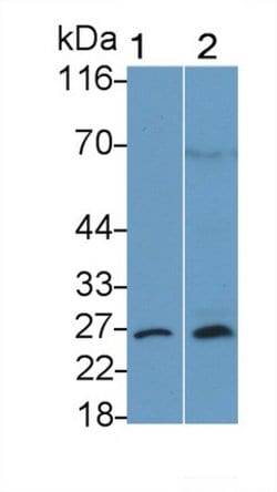 Invitrogen Bcl-2 Polyclonal Antibody:Antibodies:Primary Antibodies