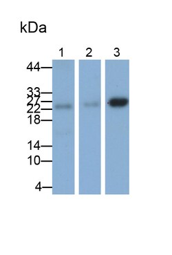 Invitrogen Bcl-2 Polyclonal Antibody:Antibodies:Primary Antibodies
