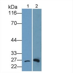 Invitrogen Bcl-2 Polyclonal Antibody:Antibodies:Primary Antibodies