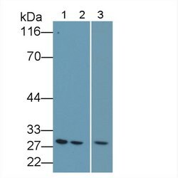Invitrogen Bcl-2 Polyclonal Antibody:Antibodies:Primary Antibodies