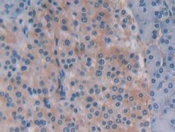 Invitrogen Beclin 1 Polyclonal Antibody:Antibodies:Primary Antibodies