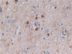 Invitrogen Beclin 1 Polyclonal Antibody:Antibodies:Primary Antibodies