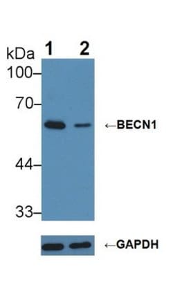 Invitrogen Beclin 1 Polyclonal Antibody:Antibodies:Primary Antibodies