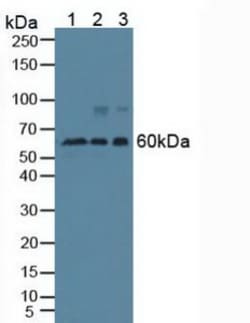 Invitrogen Beclin 1 Polyclonal Antibody:Antibodies:Primary Antibodies