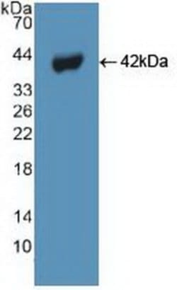 Invitrogen Beclin 1 Polyclonal Antibody:Antibodies:Primary Antibodies