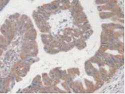 Invitrogen UPB1 Polyclonal Antibody 20 &mu;L; Unconjugated:Antibodies,