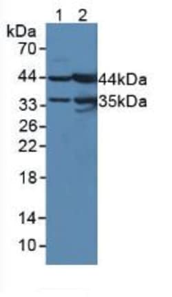 Invitrogen UPB1 Polyclonal Antibody 200 &mu;L; Unconjugated:Antibodies,