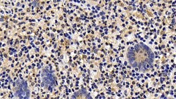 Invitrogen BID Polyclonal Antibody 200 &mu;L; Unconjugated:Antibodies,