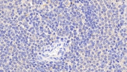 Invitrogen BID Polyclonal Antibody 200 &mu;L; Unconjugated:Antibodies,