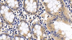 Invitrogen BID Polyclonal Antibody 200 &mu;L; Unconjugated:Antibodies,