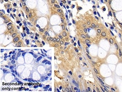 Invitrogen BID Polyclonal Antibody 200 &mu;L; Unconjugated:Antibodies,