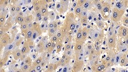 Invitrogen BID Polyclonal Antibody 200 &mu;L; Unconjugated:Antibodies,