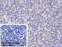 Invitrogen BID Polyclonal Antibody 200 &mu;L; Unconjugated:Antibodies,