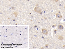 Invitrogen BID Polyclonal Antibody 200 &mu;L; Unconjugated:Antibodies,