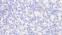 Invitrogen Biliverdin Reductase Polyclonal Antibody 20 &mu;L; Unconjugated:Antibodies,