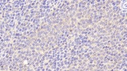 Invitrogen Biliverdin Reductase Polyclonal Antibody 20 &mu;L; Unconjugated:Antibodies,