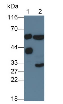 Invitrogen Biliverdin Reductase Polyclonal Antibody 200 &mu;L; Unconjugated:Antibodies,