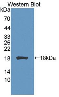 Invitrogen Biliverdin Reductase Polyclonal Antibody 200 &mu;L; Unconjugated:Antibodies,