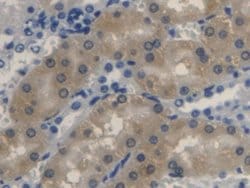 Invitrogen Biliverdin Reductase Polyclonal Antibody:Antibodies:Primary
