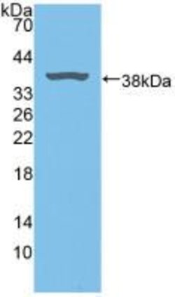 Invitrogen Biliverdin Reductase Polyclonal Antibody:Antibodies:Primary