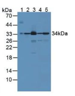 Invitrogen Biliverdin Reductase Polyclonal Antibody:Antibodies:Primary