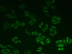 Invitrogen BLVRB Polyclonal Antibody:Antibodies:Primary Antibodies