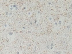 Invitrogen BLVRB Polyclonal Antibody:Antibodies:Primary Antibodies