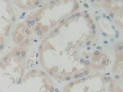 Invitrogen BLVRB Polyclonal Antibody:Antibodies:Primary Antibodies