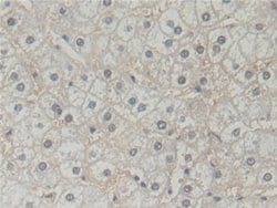Invitrogen BLVRB Polyclonal Antibody:Antibodies:Primary Antibodies
