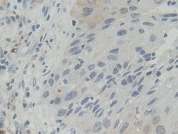 Invitrogen BLVRB Polyclonal Antibody:Antibodies:Primary Antibodies