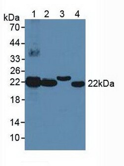 Invitrogen BLVRB Polyclonal Antibody:Antibodies:Primary Antibodies