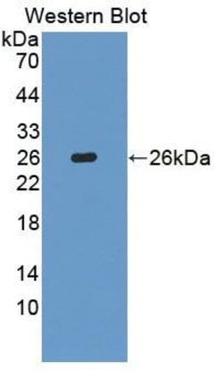 Invitrogen BLVRB Polyclonal Antibody:Antibodies:Primary Antibodies