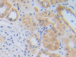 Invitrogen ZNF179 Polyclonal Antibody:Antibodies:Primary Antibodies