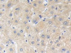 Invitrogen ZNF179 Polyclonal Antibody:Antibodies:Primary Antibodies