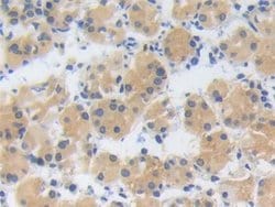 Invitrogen ZNF179 Polyclonal Antibody:Antibodies:Primary Antibodies