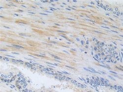 Invitrogen ZNF179 Polyclonal Antibody:Antibodies:Primary Antibodies
