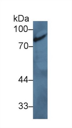 Invitrogen ZNF179 Polyclonal Antibody:Antibodies:Primary Antibodies