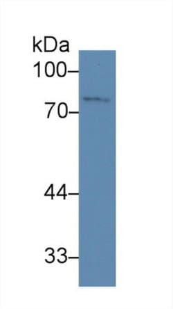 Invitrogen ZNF179 Polyclonal Antibody:Antibodies:Primary Antibodies