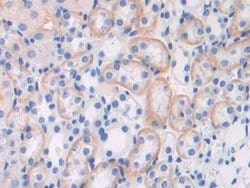 Invitrogen Brevican Polyclonal Antibody 20 &mu;L; Unconjugated:Antibodies,