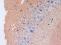 Invitrogen Brevican Polyclonal Antibody 20 &mu;L; Unconjugated:Antibodies,