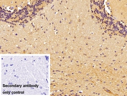 Invitrogen Brevican Polyclonal Antibody 20 &mu;L; Unconjugated:Antibodies,