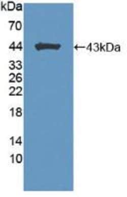 Invitrogen Brevican Polyclonal Antibody 20 &mu;L; Unconjugated:Antibodies,