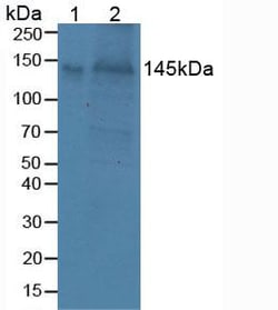 Invitrogen Brevican Polyclonal Antibody 20 &mu;L; Unconjugated:Antibodies,