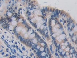 Invitrogen CDH16 Polyclonal Antibody 20 &mu;L; Unconjugated:Antibodies,