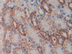 Invitrogen CDH16 Polyclonal Antibody:Antibodies:Primary Antibodies