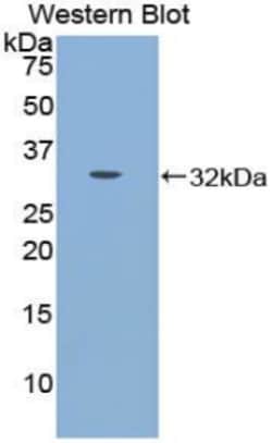 Invitrogen CDH16 Polyclonal Antibody 20 &mu;L; Unconjugated:Antibodies,