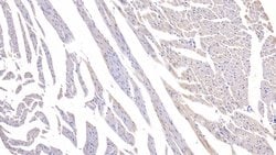 Invitrogen CaMKII gamma Polyclonal Antibody:Antibodies:Primary Antibodies