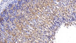 Invitrogen CaMKII gamma Polyclonal Antibody:Antibodies:Primary Antibodies