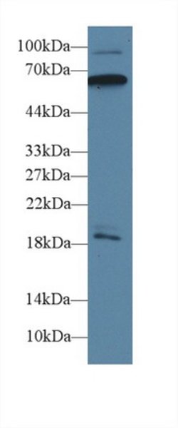 Invitrogen CaMKII gamma Polyclonal Antibody 20 &mu;L; Unconjugated:Antibodies,